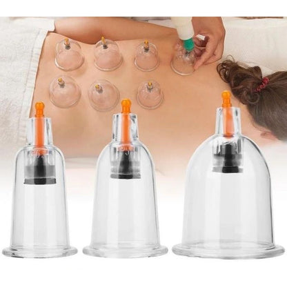 Alat Bekam Kop Angin Isi 6Pcs / Kepala Tabung Cup Isap Untuk Mengobati Masuk Angin Dan Kesehatan Tubuh / Pull Out A Vacuum Apparatus / Cupping Therapy Tools Cangkir Terapi Detoks Tubuh Tuas Pompa Sedot