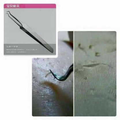 Pinset Jepit Komedo Stainless Steel Blackhead Tweezer / Alat Capit Untuk Menghilangkan Komedo / Penjepit Komedo