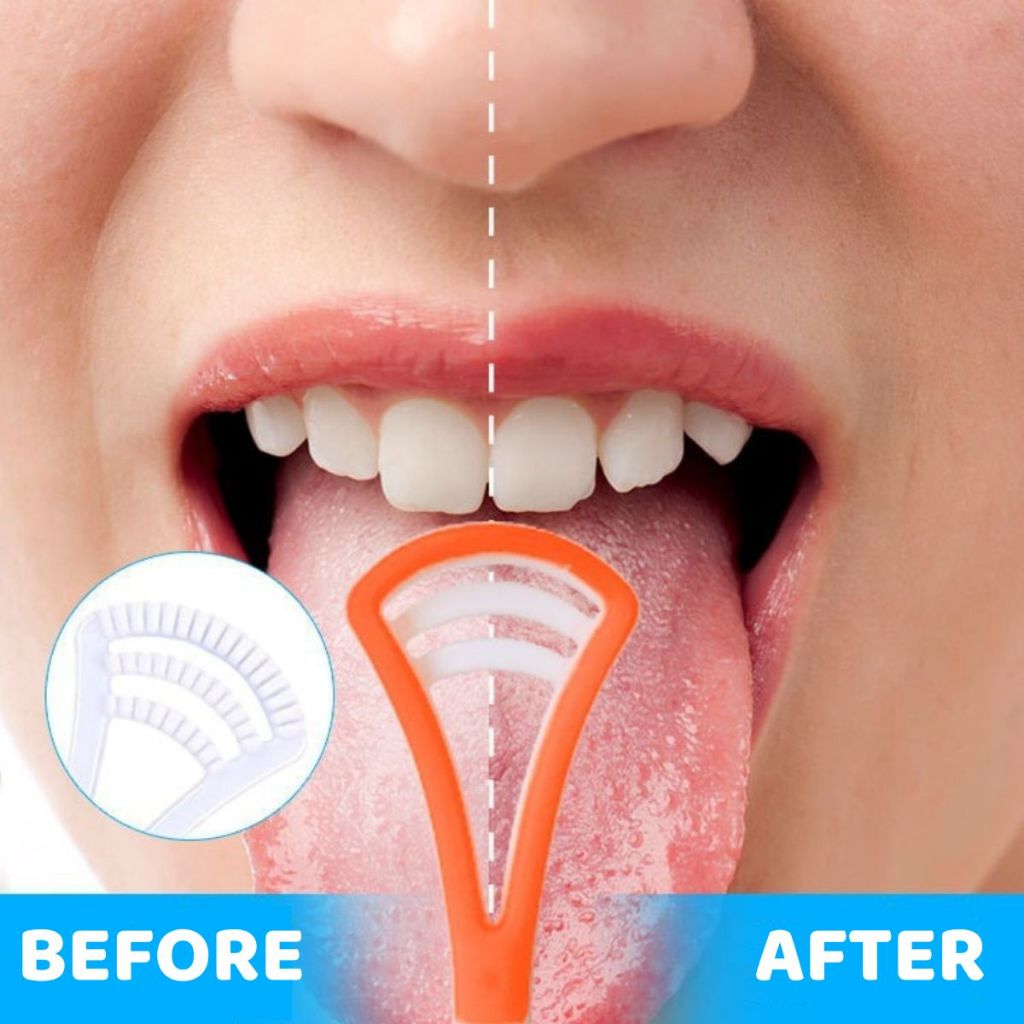 Sikat Pembersih Lidah Tongue Cleaner Scraper / Alat Pengangkat Kotoran Plak Lapisan Putih Kuman Bakteri Jamur Penghilang Bau Mulut Tak Sedap Bahan Plastik + Silicone Mudah Dibersihkan / Perawatan Kebersihan Lidah Mulut Gigi Nafas Segar Gerigi Rubbery