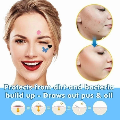 Acne Pimple Patch Bentuk Bintang (1 Lembar Isi 36 Patch) / Speedy Solution Anti Trouble Patch Sticker Tempelan Penghilang Pengangkat Isi Jerawat Kempes Warna-Warni Siang Malam Asam Salisilat / Stiker Perawatan Kulit Skin Repair Karakter Lucu